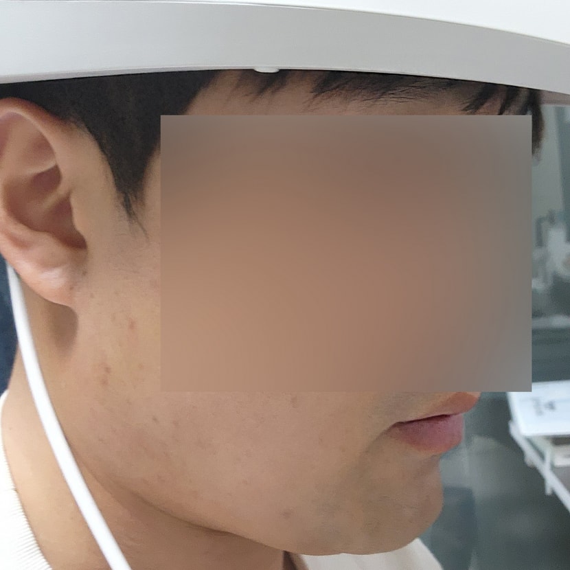 메디헤어 제품 사용 하는 사진
