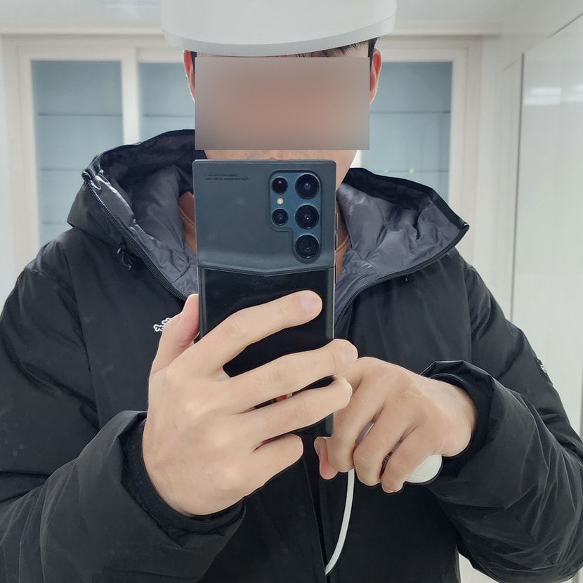 메디헤어 사용 사진