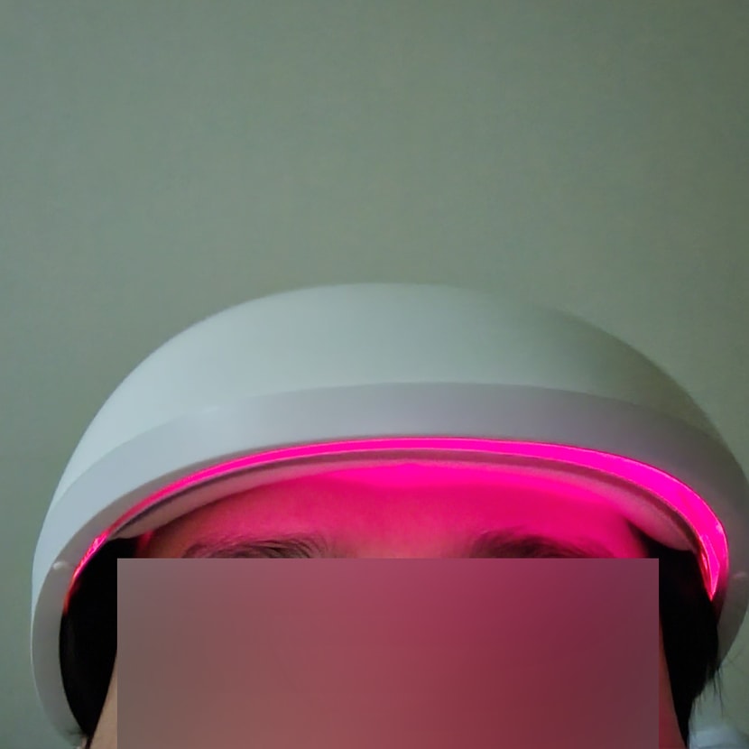메디헤어 사용2