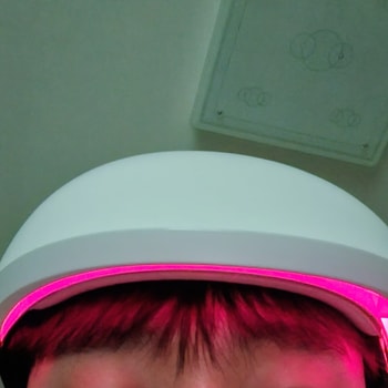 메디헤어 사용 사진
