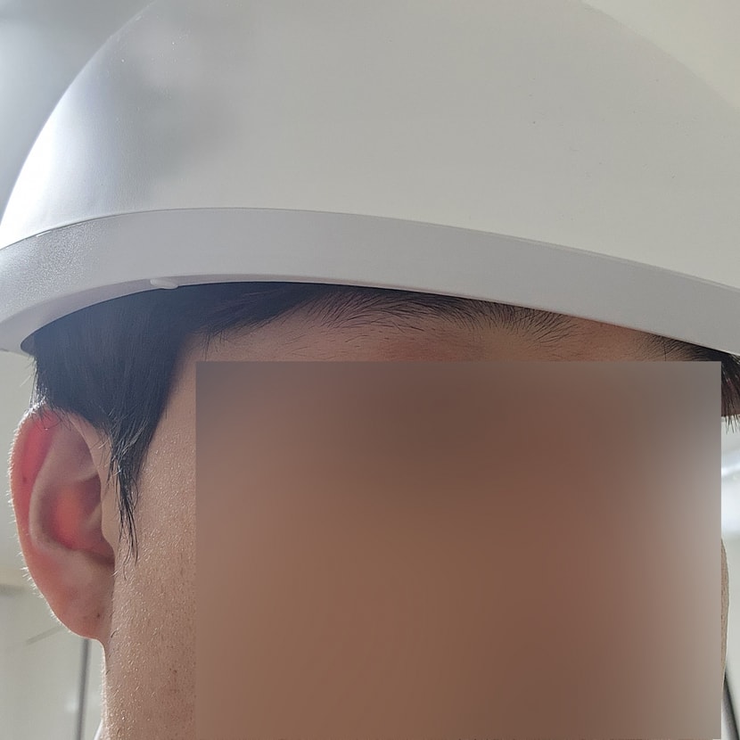 메디헤어 사용1
