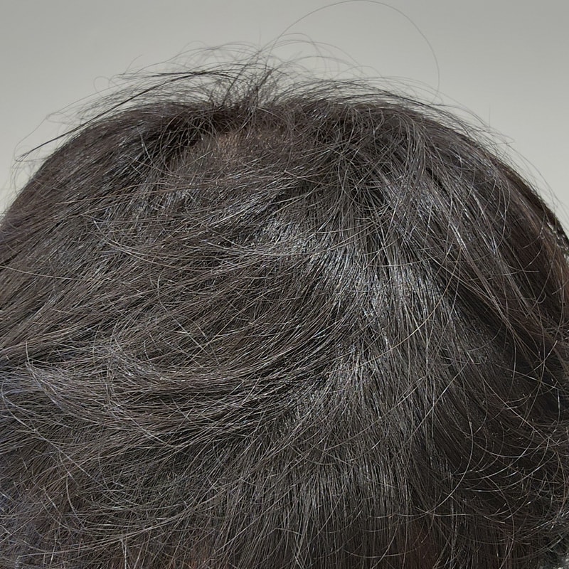 パントモナ4週目の服用体験談を共有します。