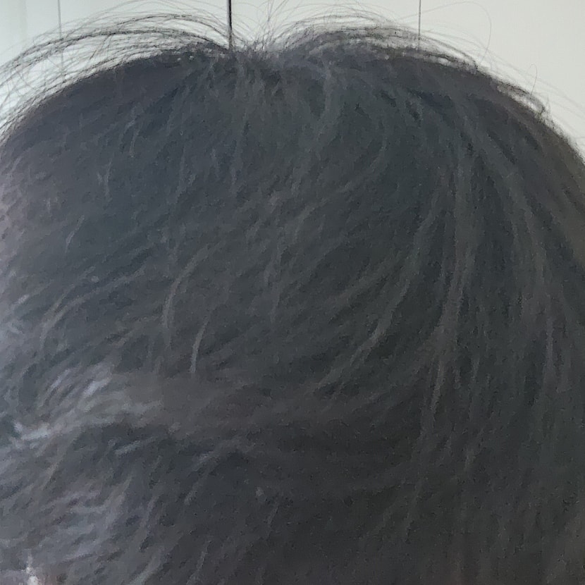 현재 정수리 사진