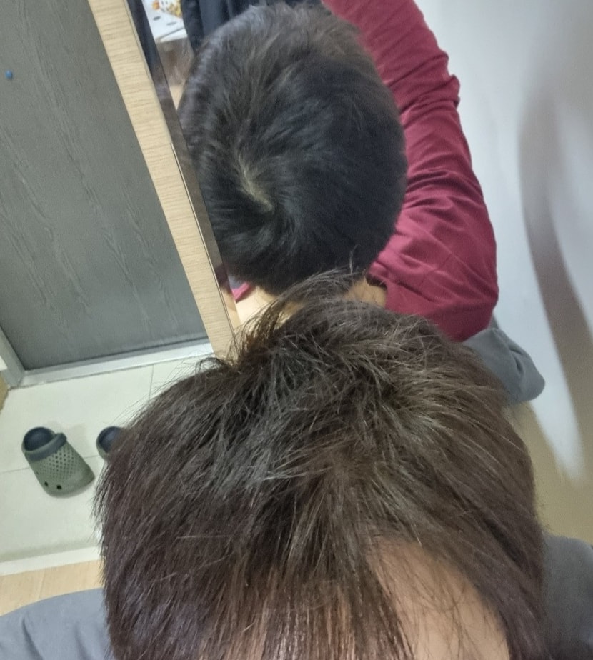 복용4주후