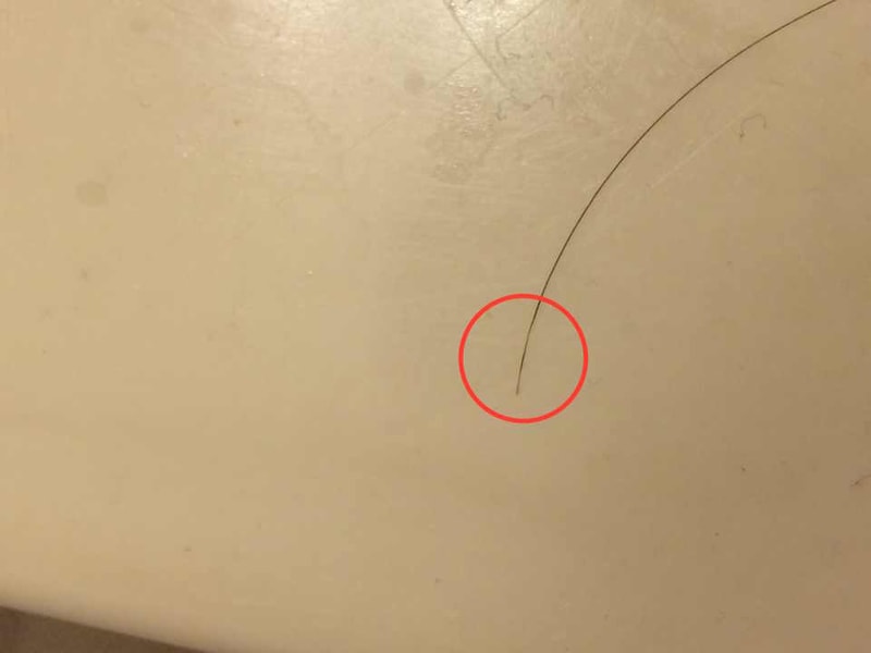 Question about hair condition (thickness irregular...)
