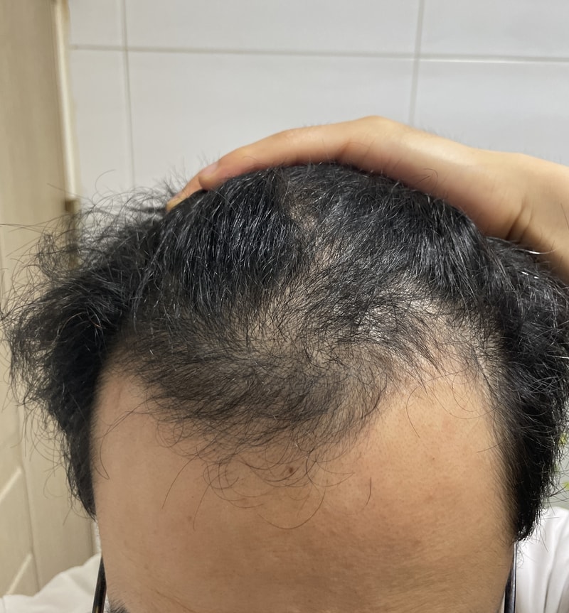 Please give me a simple estimate ^^