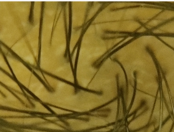 정수리 확대 사진