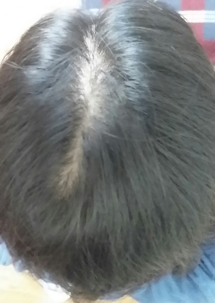 위, 뒷부분