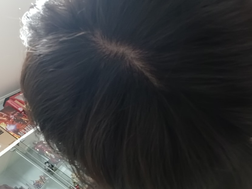 1년전 정수리