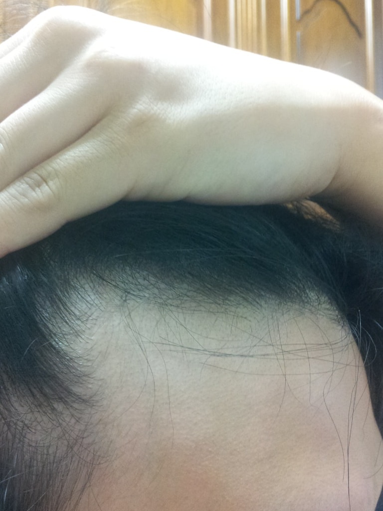 Please give me an estimate.