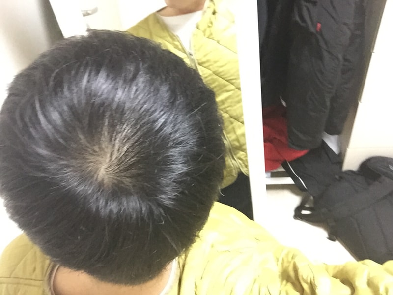 비용및시기 문의드립니다.