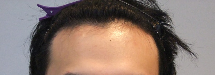 현재