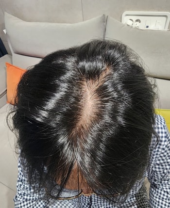 어제사진