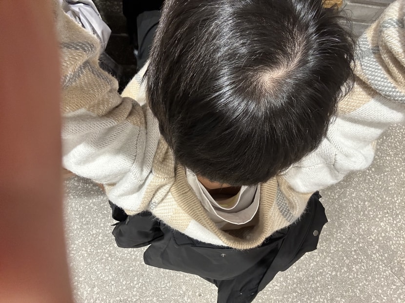 정수리