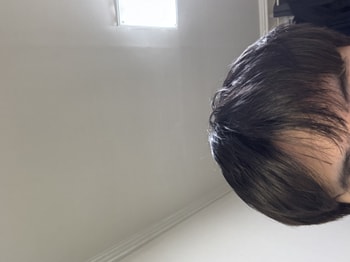 앞머리갈라짐 