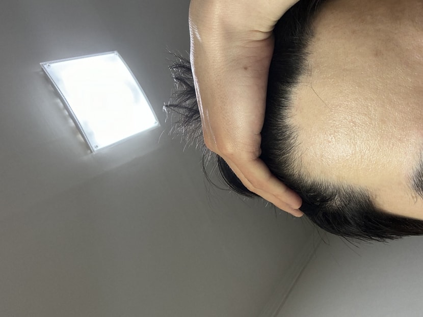 이마