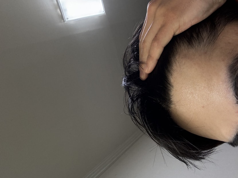 이마2