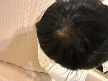 머리감고 말린후