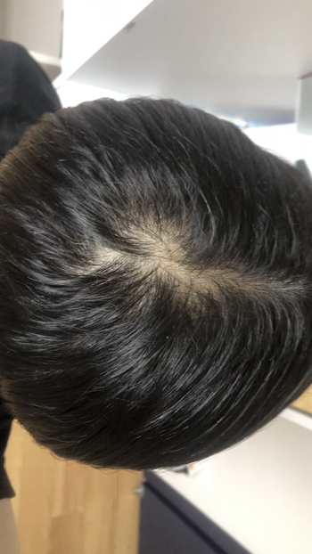 5ㄷ5 가르마 탔을 때 입니다