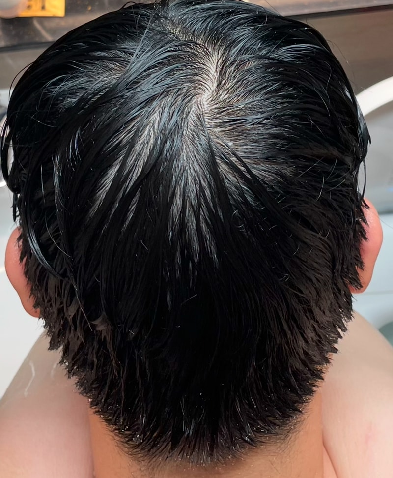 피나엠 5개월차 빠른 연모화
