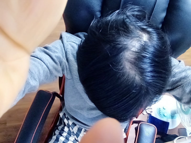 두피문신 가격