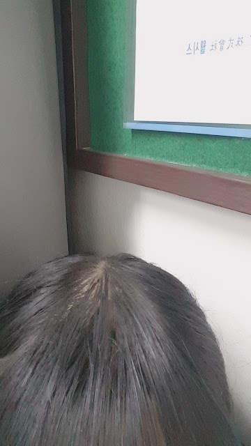 제 머리 상태좀 봐주세요