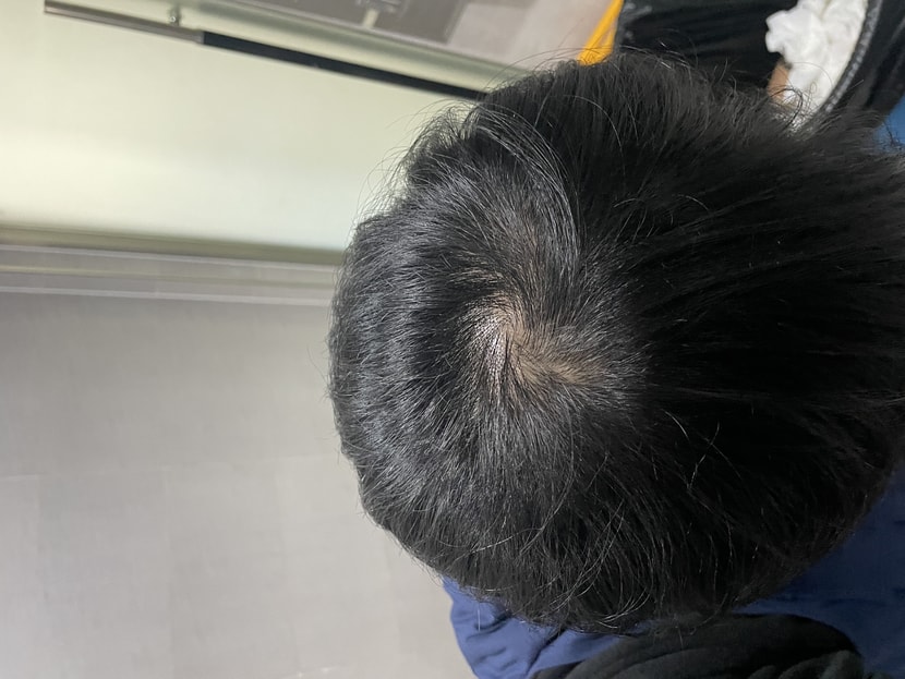 정수리