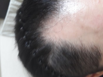 오른쪽 엠자부분