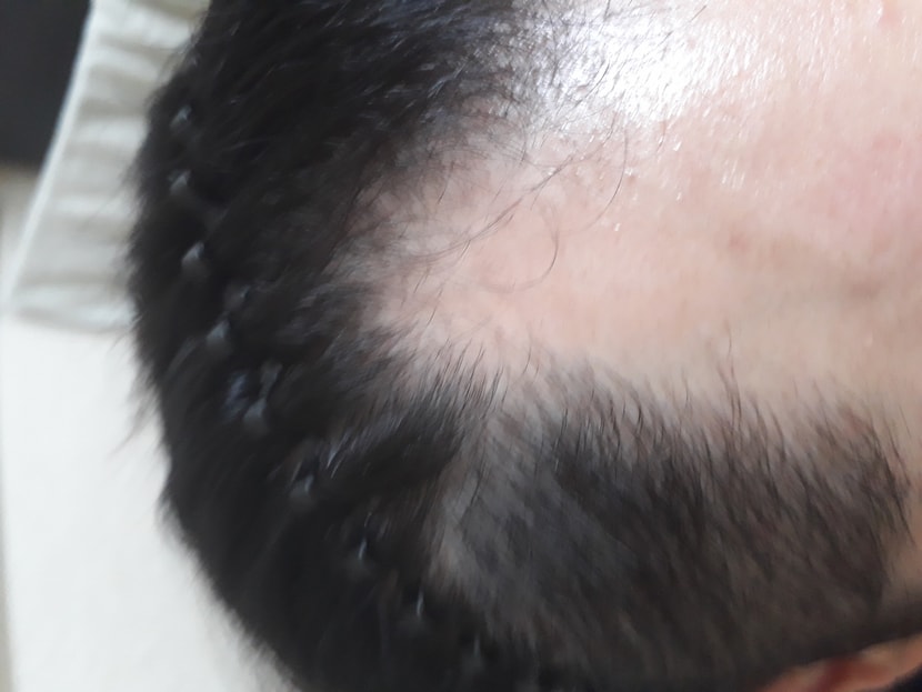 오른쪽 엠자부분