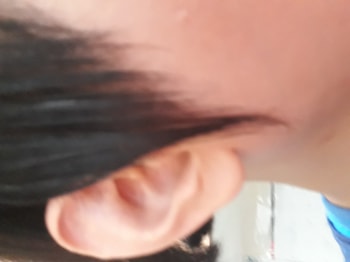 오른쪽 구렛나루