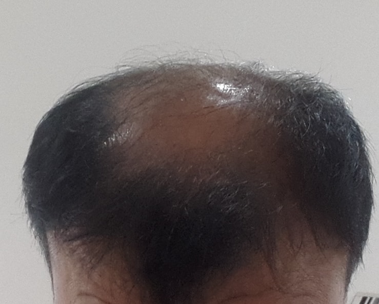 원장님 상담 좀 부탁 드립니다.