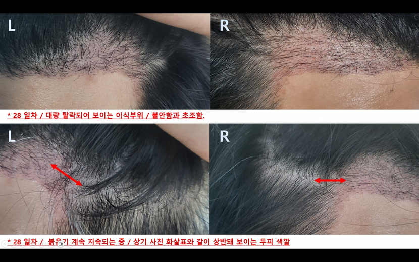 28일차