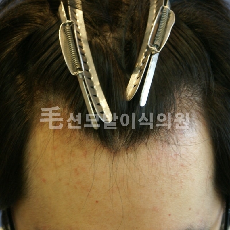 견적부탁드립니다