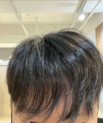 머리 막 흔들면 이리됩니다