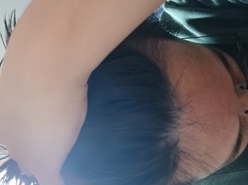 1년전 이마