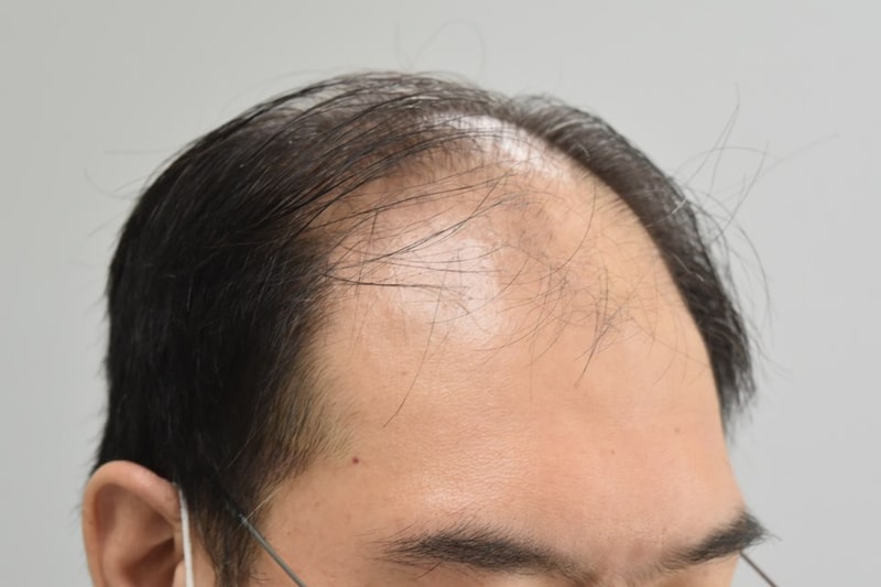 김성일수술전.jpg