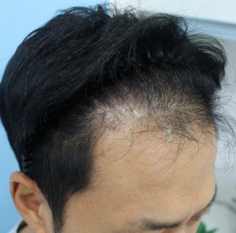 수술전(우측).jpg