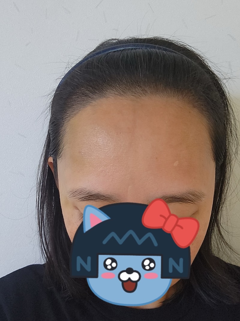 후2.jpg