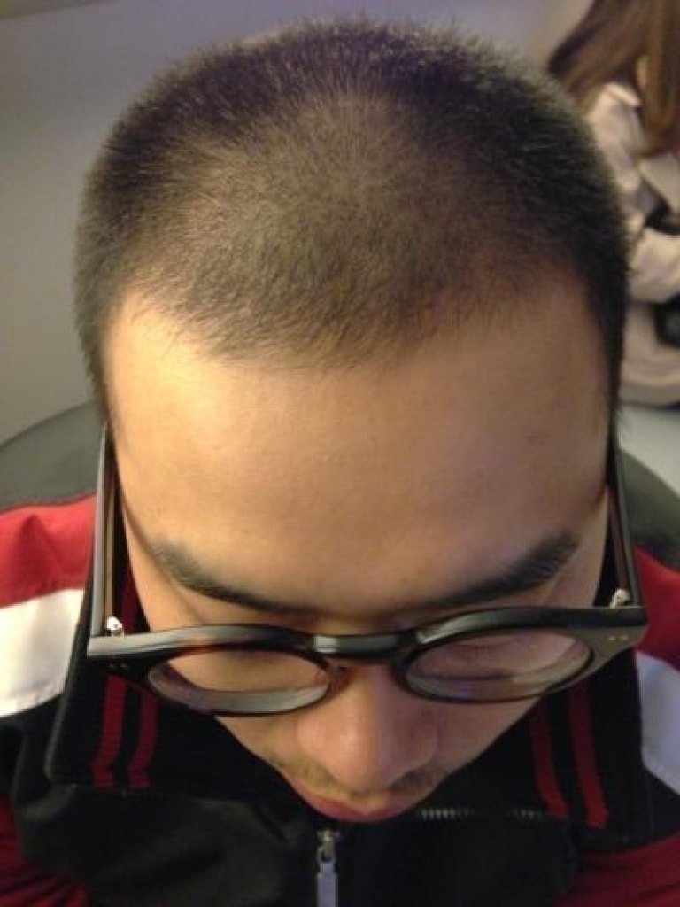 [Four Hair] Daegu Four Hair 130 days non-cut review.