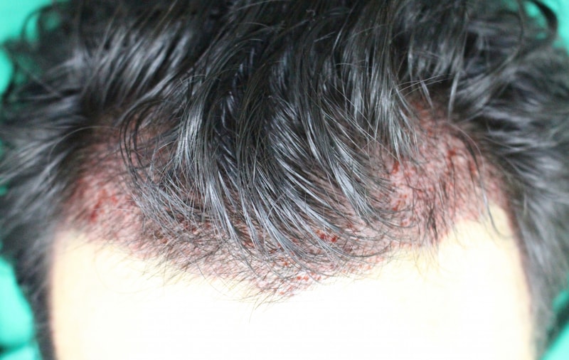수술후1.jpg