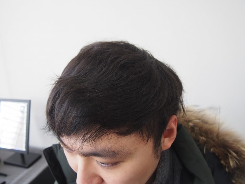 It's the 8 month review of the hair follicle of the parent body