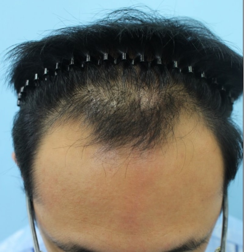 大家好 这是第一张照片的后记