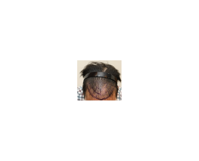 수술전 1.png
