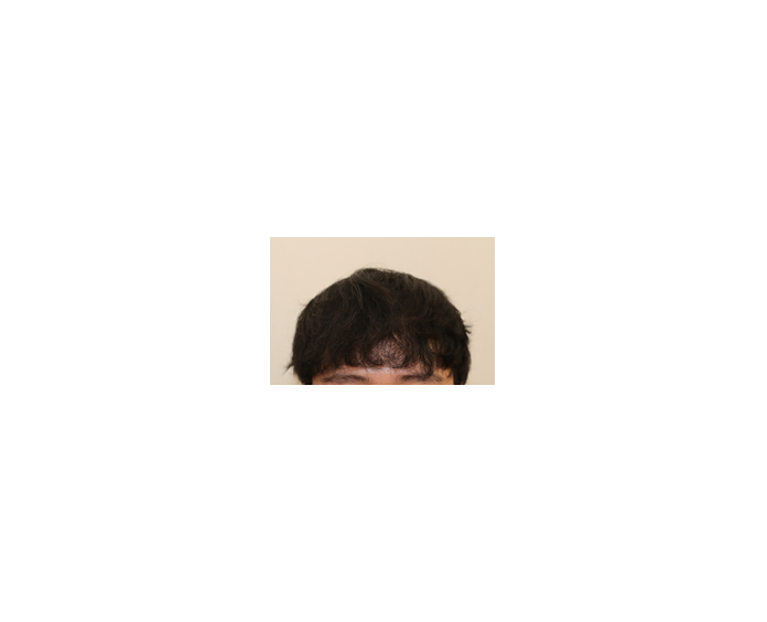 수술후2.png