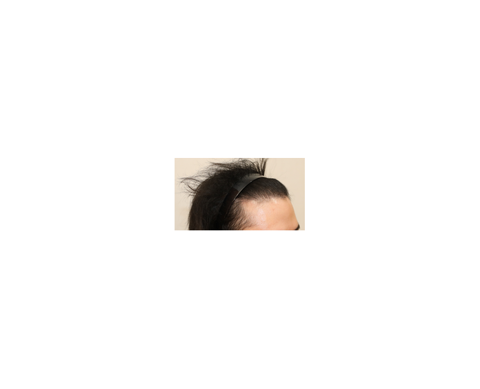 수술후1.png