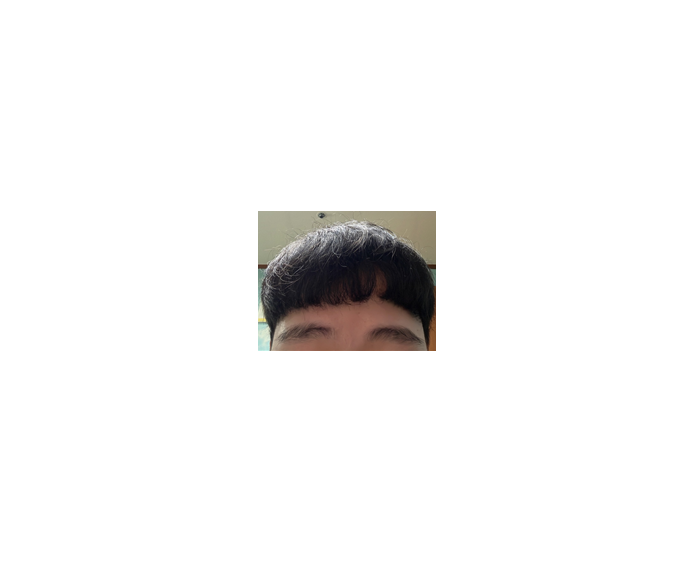 수술 후 일상.png