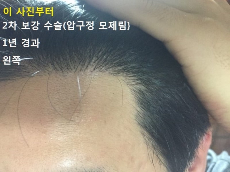 왼쪽.jpg