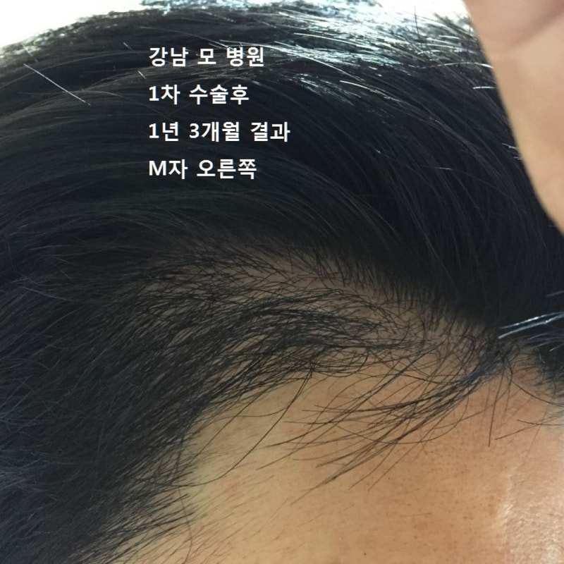 오른쪽22.jpg