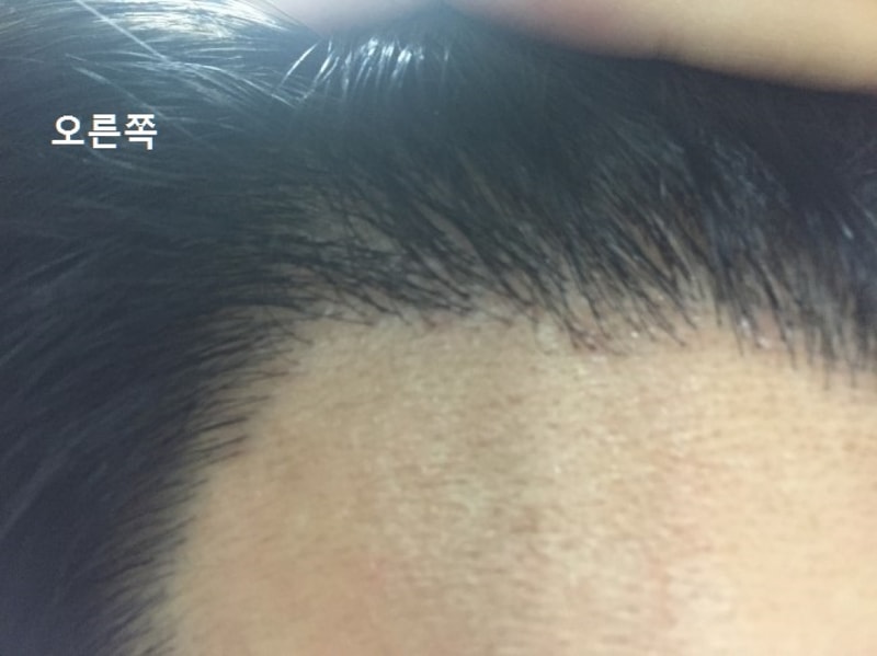 오른쪽.jpg