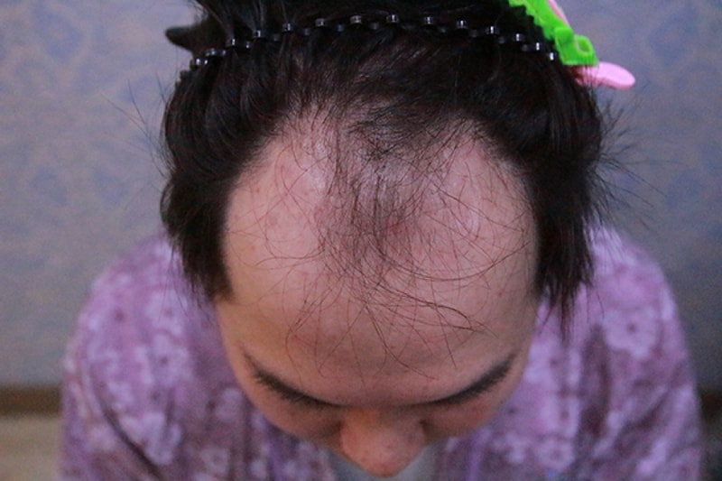 수술전.JPG